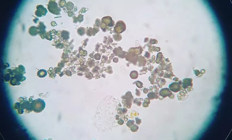 Img 20210317 000457 092