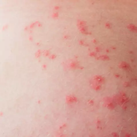 Kropivyanka 1 477x477 9d3.jpg.pagespeed.ce .1ne8dfzdyz