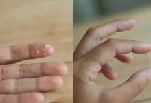 48b4f511ea5b1a2f4d72c0de05672fa6 Large