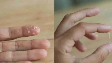 48b4f511ea5b1a2f4d72c0de05672fa6 Large